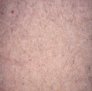 mdf-13